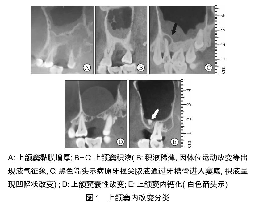 上颌窦内改变分类
