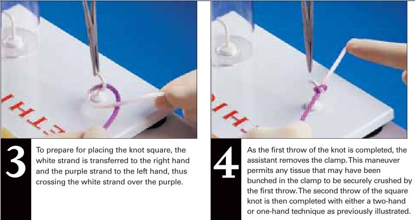 6ligation_around_hemostatic_clamp2
